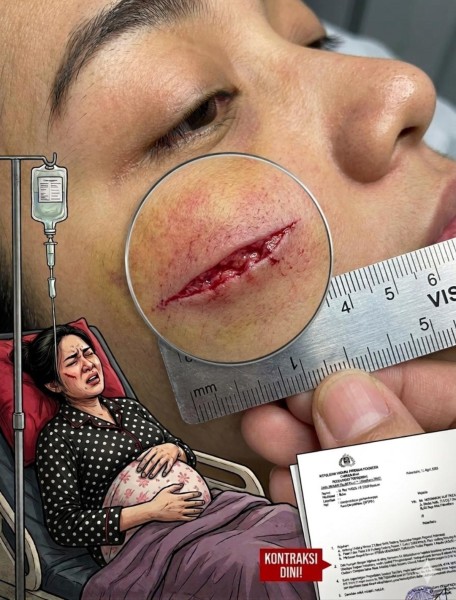 Dokter Hamil Tua Dianiaya, Kuasa Hukum Desak Polresta Pekanbaru Segera Tetapkan Tersangka